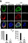 Fig.3.A showing Immunocytochemistry-immunofluorescence from the publication: Vasodilator-stimulated phosphoprotein promotes liver metastasis of gastrointestinal cancer by activating a β1-integrin-FAK-YAP1/TAZ signaling pathway.