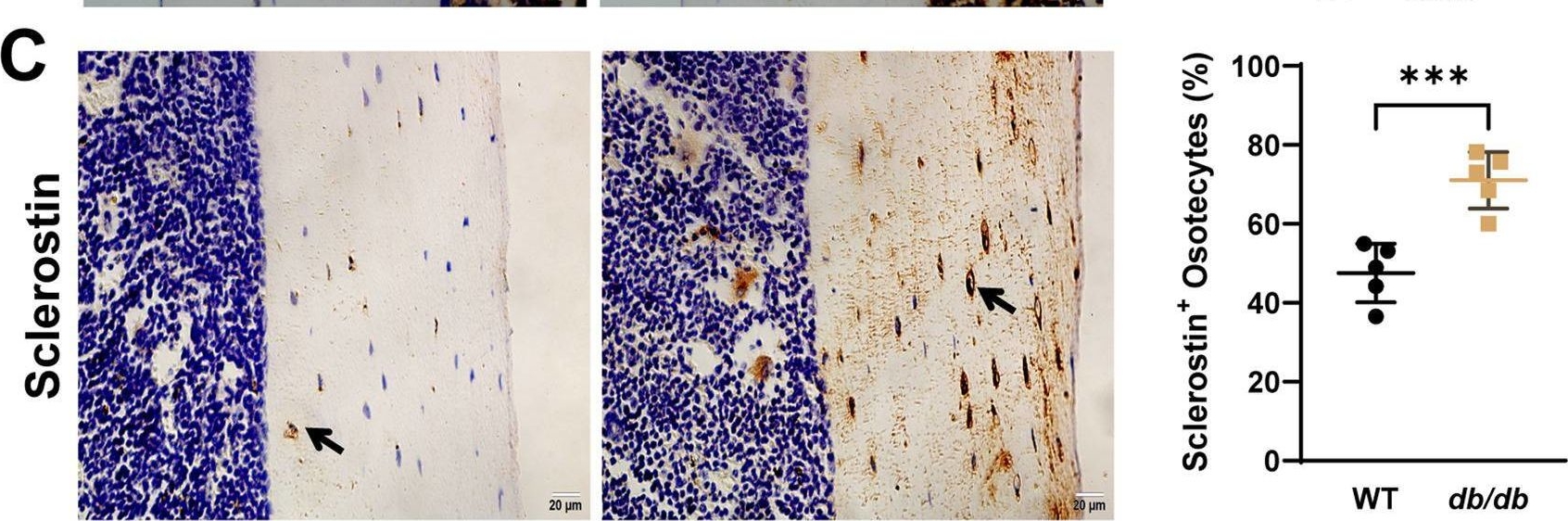 Fig.5.C showing Immunohistochemistry in a Mus musculus (House mouse) sample from the publication: Localized sclerostin accumulation in osteocyte lacunar-canalicular system is associated with cortical bone microstructural alterations and bone fragility in db/db male mice.