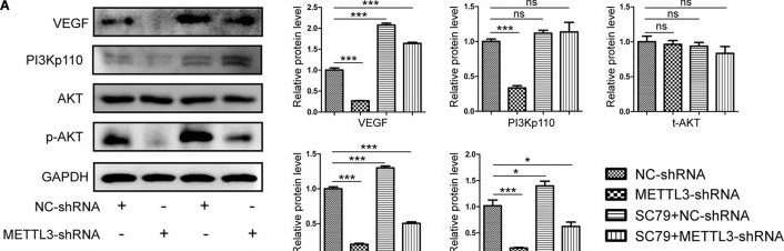 Fig.4.A showing Western Blotting from the publication: The RNA Methyltransferase METTL3 Promotes Endothelial Progenitor Cell Angiogenesis in Mandibular Distraction Osteogenesis via the PI3K/AKT Pathway.