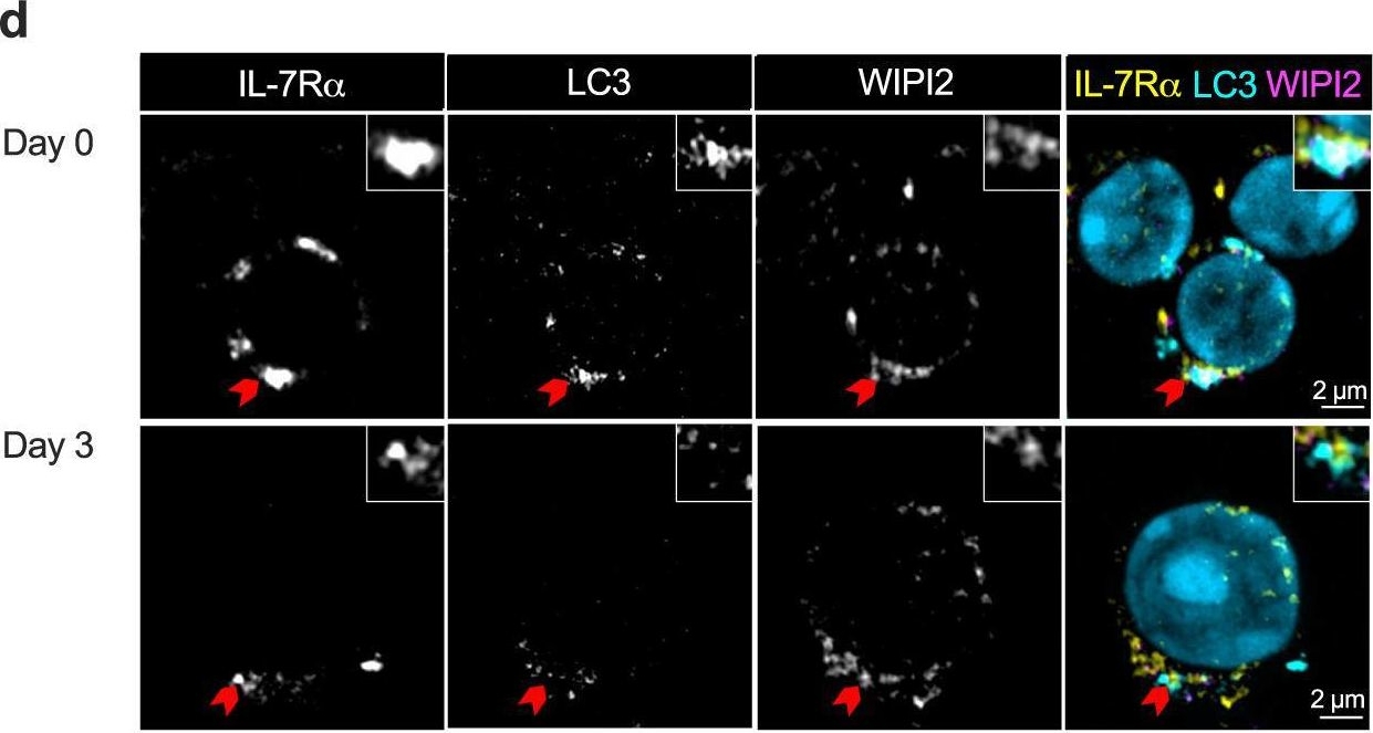 Fig.3.D showing Immunocytochemistry-immunofluorescence in a Mus musculus (House mouse) sample from the publication: Mapping autophagosome contents identifies interleukin-7 receptor-α as a key cargo modulating CD4+ T cell proliferation.