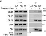 Fig.2.D showing Western Blotting from the publication: Retinoblastoma protein as an intrinsic BRD4 inhibitor modulates small molecule BET inhibitor sensitivity in cancer.
