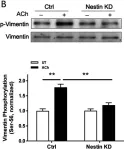 Fig.4.B showing Western Blotting from the publication: The intermediate filament protein nestin serves as a molecular hub for smooth muscle cytoskeletal signaling.