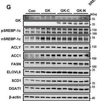 Fig.7.G showing Western Blotting from the publication: Glycerol Kinase Drives Hepatic de novo Lipogenesis and Triglyceride Synthesis in Nonalcoholic Fatty Liver by Activating SREBP-1c Transcription, Upregulating DGAT1/2 Expression, and Promoting Glycerol Metabolism.