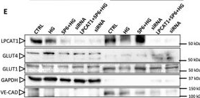 Fig.3.E showing Western Blotting from the publication: Lysolecithin reprogramming via LPCAT1 modulation restores endothelial function and prevents diabetes-associated dysmetabolism.