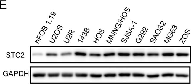 Fig.4.E showing Western Blotting from the publication: Construction of an ER stress-related prognostic signature for predicting prognosis and screening the effective anti-tumor drug in osteosarcoma.