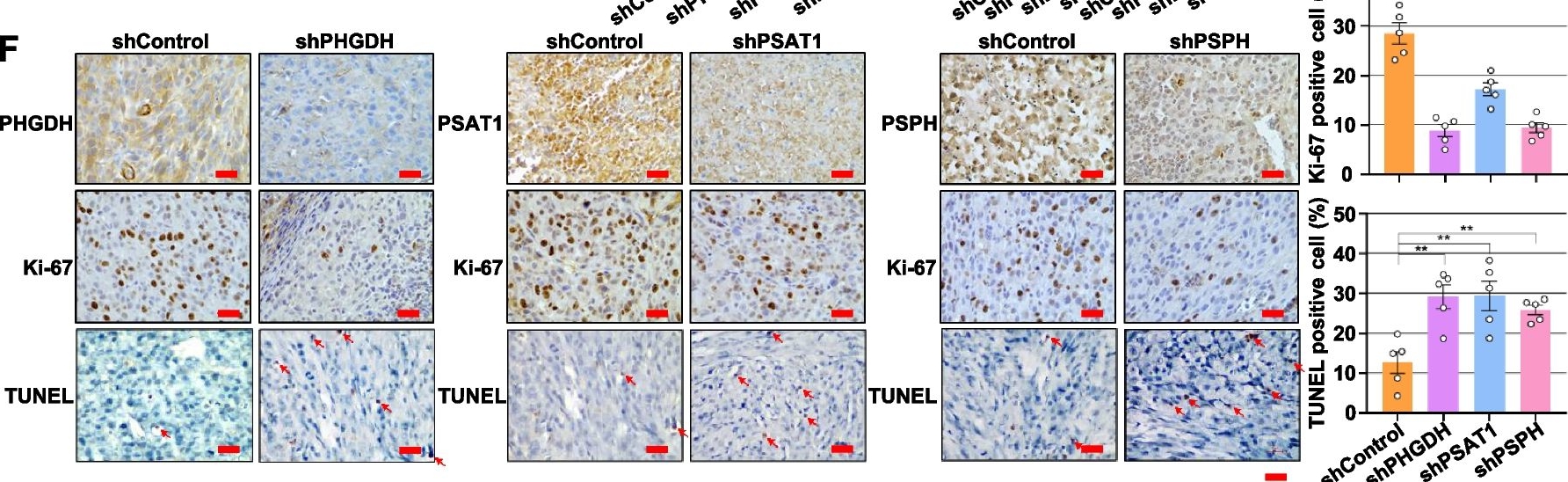 Fig.3.F showing Immunohistochemistry from the publication: AMPK-HIF-1α signaling enhances glucose-derived de novo serine biosynthesis to promote glioblastoma growth.