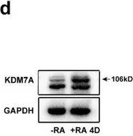 Fig.1.D showing Western Blotting in a Mus musculus (House mouse) sample from the publication: The Lysine Demethylase KDM7A Regulates Immediate Early Genes in Neurons.