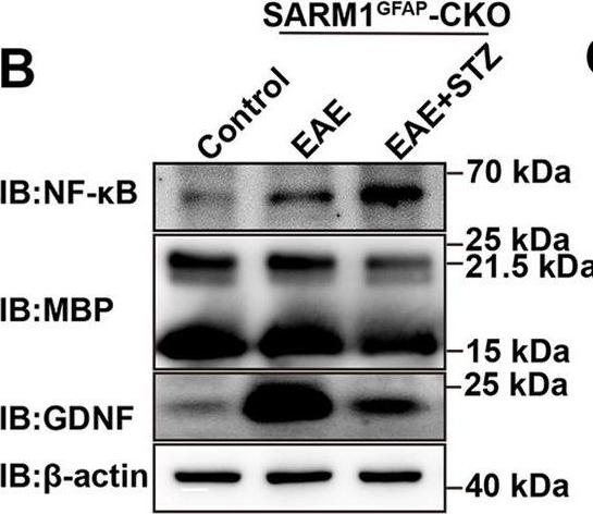 Fig.7.B showing Western Blotting in a Mus musculus (House mouse) sample from the publication: Astrocytic SARM1 promotes neuroinflammation and axonal demyelination in experimental autoimmune encephalomyelitis through inhibiting GDNF signaling.