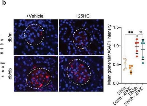 Fig.5.B showing Immunohistochemistry-immunofluorescence in a Mus musculus (House mouse) sample from the publication: Cholesterol 25-Hydroxylase Protects Against Diabetic Kidney Disease by Regulating ADP Ribosylation Factor 4.
