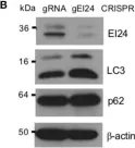 Fig.4.B showing Western Blotting in a Homo sapiens (Human) sample from the publication: EI24, as a Component of Autophagy, Is Involved in Pancreatic Cell Proliferation.