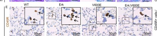 Fig.2.U showing Immunohistochemistry in a Mus musculus (House mouse) sample from the publication: Differential contribution for ERK1 and ERK2 kinases in BRAFV600E-triggered phenotypes in adult mouse models.