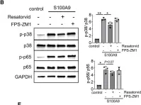 Fig.2.B showing Western Blotting in a Homo sapiens (Human) sample from the publication: S100A9 and HMGB1 orchestrate MDSC-mediated immunosuppression in melanoma through TLR4 signaling.