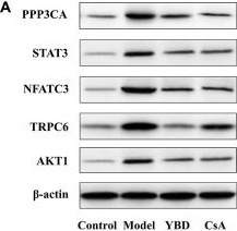 Fig.14.A showing Western Blotting in a Rattus norvegicus (Rat) sample from the publication: Exploring the therapeutic mechanism of Yuebi decoction on nephrotic syndrome based on network pharmacology and experimental study.