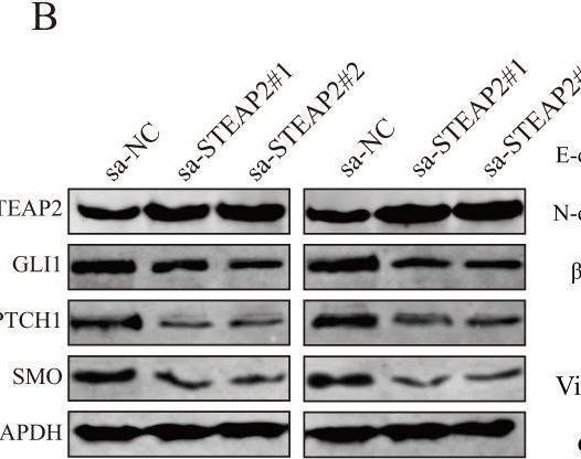 Fig.5.B showing Western Blotting from the publication: METTL3-mediated m6A modification of STEAP2 mRNA inhibits papillary thyroid cancer progress by blocking the Hedgehog signaling pathway and epithelial-to-mesenchymal transition.