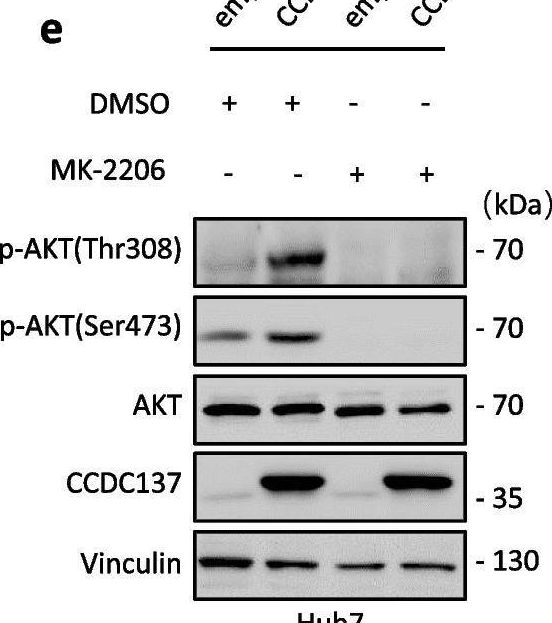 Fig.4.E showing Western Blotting in a Homo sapiens (Human) sample from the publication: RNA-binding protein CCDC137 activates AKT signaling and promotes hepatocellular carcinoma through a novel non-canonical role of DGCR8 in mRNA localization.