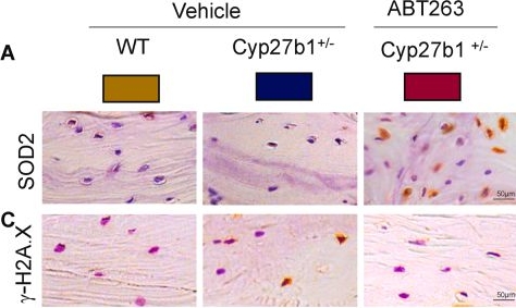 Fig.5.A showing Immunohistochemistry in a Mus musculus (House mouse) sample from the publication: The senolytic agent ABT263 ameliorates osteoporosis caused by active vitamin D insufficiency through selective clearance of senescent skeletal cells.