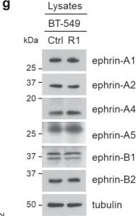 Fig.5.G showing Western Blotting in a Homo sapiens (Human) sample from the publication: Human ribonuclease 1 serves as a secretory ligand of ephrin A4 receptor and induces breast tumor initiation.