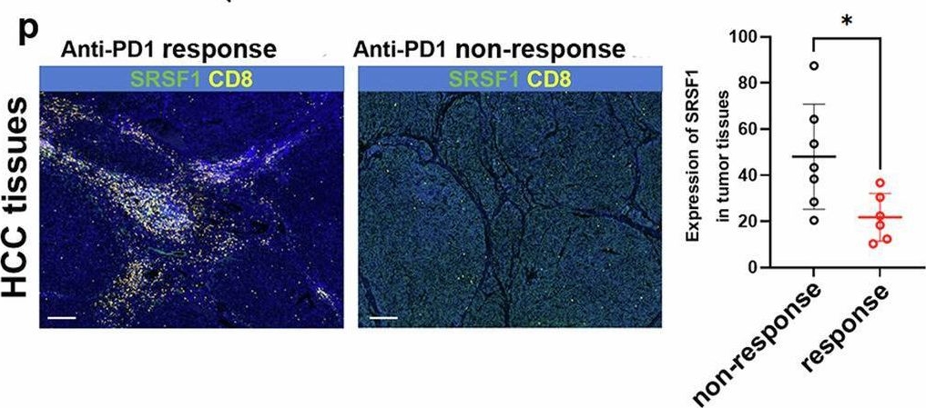 Fig.6.P showing Immunohistochemistry-immunofluorescence from the publication: Targeting SRSF1 improves cancer immunotherapy by dually acting on CD8+T and tumor cells.