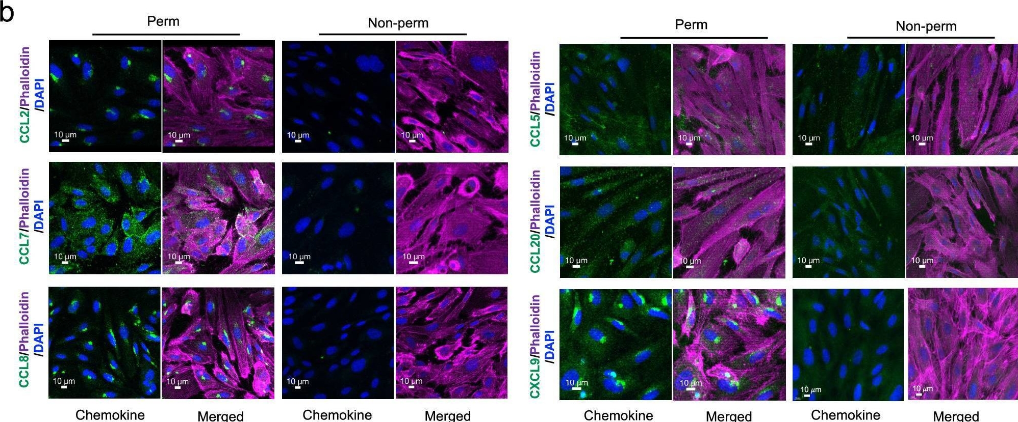 Fig.6.B showing Immunohistochemistry-immunofluorescence in a Homo sapiens (Human) sample from the publication: Migration arrest and transendothelial trafficking of human pathogenic-like Th17 cells are mediated by differentially positioned chemokines.