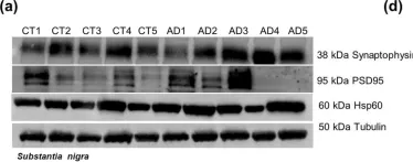 Fig.10.A showing Western Blotting from the publication: Differential protein expression in diverse brain areas of Parkinson's and Alzheimer's disease patients.