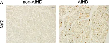 Nrf2 Polyclonal Antibody – Bioss