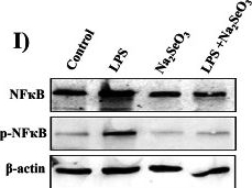 Fig.3.I showing Western Blotting from the publication: Sodium Selenite Preconditioning Reprograms Mesenchymal Stem Cell Behavior Under Inflammatory Stress to Enhance Anti-Inflammatory Macrophage Responses.