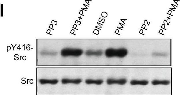 Fig.8.I from the publication: α1-Adrenergic receptor-PKC-Pyk2-Src signaling boosts L-type Ca2+ channel CaV1.2 activity and long-term potentiation in rodents.