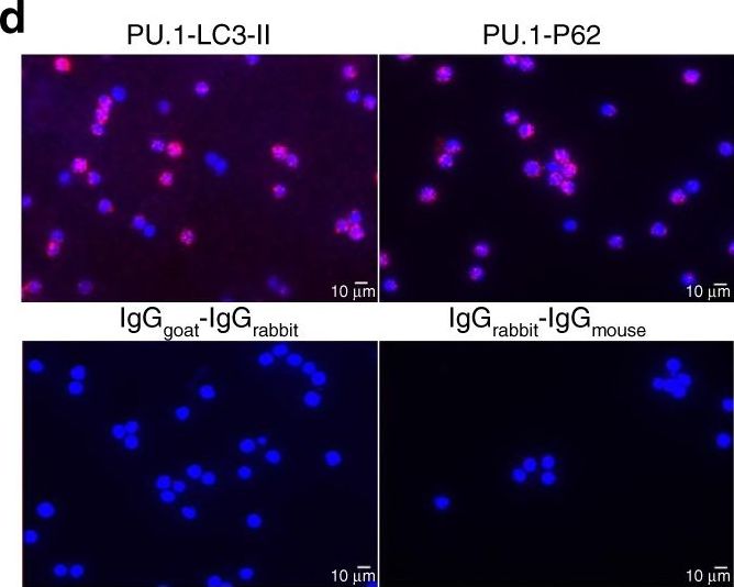 Selective degradation of PU.1 during autophagy represses the differentiation and antitumour activity of TH9 cells.