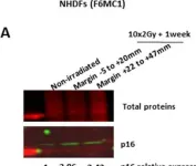 Fig.2.A showing Western Blotting from the publication: The out-of-field dose in radiation therapy induces delayed tumorigenesis by senescence evasion.