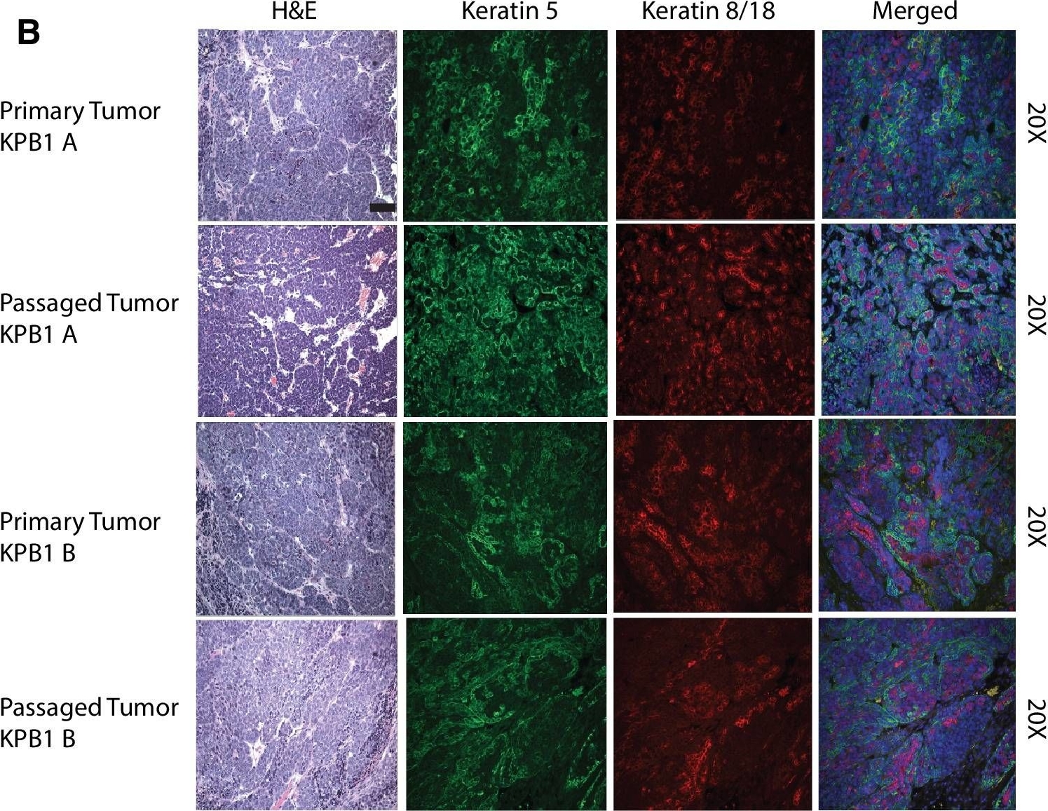 A mouse model featuring tissue-specific deletion of p53 and Brca1 gives rise to mammary tumors with genomic and transcriptomic similarities to human basal-like breast cancer.