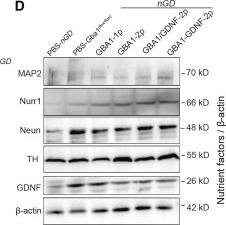 Fig.5.D showing Western Blotting from the publication: AAV-mediated GBA1 and GDNF rescue neurological defects in a murine model of neuronopathic Gaucher disease.