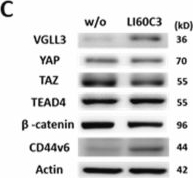 Fig.6.C showing Western Blotting from the publication: Emergence of invasive Escherichia coli pathobionts in gut microbiome promotes cancer stemness via targeting Hippo pathways.