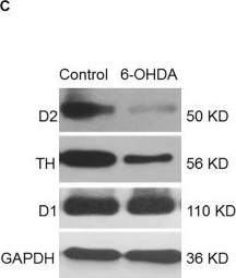Fig.2.C showing Western Blotting in a Rattus norvegicus (Rat) sample from the publication: Downregulated Dopamine Receptor 2 and Upregulated Corticotrophin Releasing Hormone in the Paraventricular Nucleus Are Correlated With Decreased Glucose Tolerance in Rats With Bilateral Substantia Nigra Lesions.