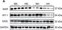 WT1 (D8I7F) XP® Rabbit mAb | Cell Signaling Technology