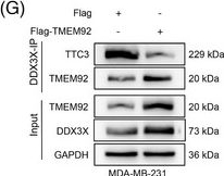 Fig.5.G showing Western Blotting in a Homo sapiens (Human) sample from the publication: TMEM92 shields DDX3X from TTC3-mediated degradation to confer chemoresistance in triple-negative breast cancer.