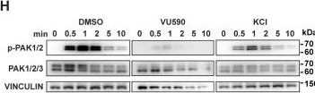 Fig.5.H showing Western Blotting from the publication: Inwardly rectifying potassium channels promote directional sensing during neutrophil chemotaxis.