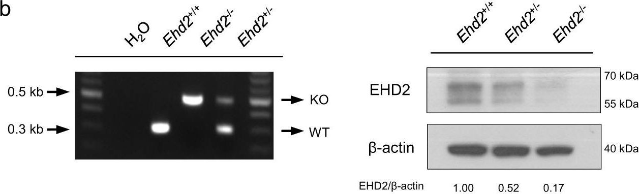 Fig.7.B showing Western Blotting in a Mus musculus (House mouse) sample from the publication: Hypoxia-induced macropinocytosis represents a metabolic route for liver cancer.