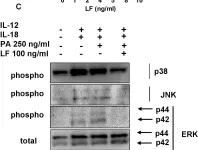 Fig.4.C showing Western Blotting from the publication: Mechanisms of NK cell-macrophage Bacillus anthracis crosstalk: a balance between stimulation by spores and differential disruption by toxins.