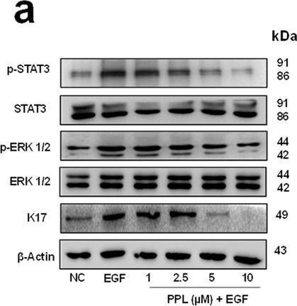 Fig.3.A showing Western Blotting in a Homo sapiens (Human) sample from the publication: Piperlongumine regulates epigenetic modulation and alleviates psoriasis-like skin inflammation via inhibition of hyperproliferation and inflammation.