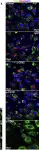 Fig.1.E showing Immunocytochemistry-immunofluorescence from the publication: Mycobacterium abscessus alkyl hydroperoxide reductase C promotes cell invasion by binding to tetraspanin CD81.