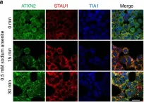 Fig.1.A showing Immunofluorescence in a Mus musculus (House mouse) sample from the publication: Staufen1 links RNA stress granules and autophagy in a model of neurodegeneration.