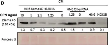 Fig.5.D showing Western Blotting from the publication: Cytokine profiling in plasma distinguishes the histological inflammatory subtype of head and neck squamous cell carcinoma and a novel regulatory role of osteopontin.
