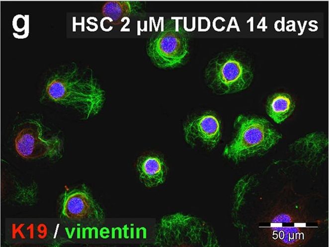 Bile acids induce hepatic differentiation of mesenchymal stem cells.