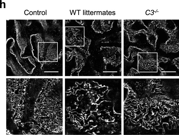 Fig.5.H showing Immunohistochemistry-immunofluorescence in a Homo sapiens (Human) sample from the publication: The classical pathway triggers pathogenic complement activation in membranous nephropathy.