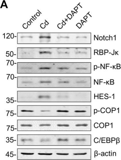 Fig.6.A showing Western Blotting in a Mus musculus (House mouse) sample from the publication: DAPT Attenuates Cadmium-Induced Toxicity in Mice by Inhibiting Inflammation and the Notch/HES-1 Signaling Axis.