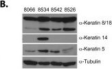 NOTCH1 inhibition in vivo results in mammary tumor regression and reduced mammary tumorsphere-forming activity in vitro.