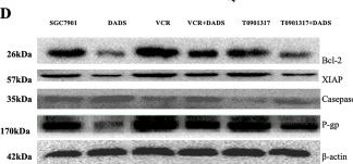 Fig.6.D showing Western Blotting from the publication: DADS Regulates EMT and Chemotherapy Resistance by Inhibiting RORα/β-Catenin Signaling through PKCα-Dependent Phosphorylation in Gastric Cancer.