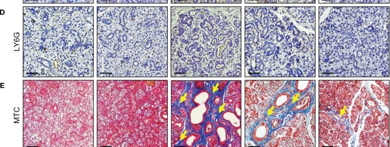 Fig.3.D showing Immunohistochemistry in a Mus musculus (House mouse) sample from the publication: Retroductal dexamethasone administration promotes the recovery from obstructive and inflammatory salivary gland dysfunction.