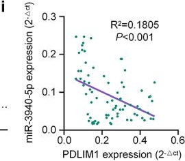 Fig.4.I from the publication: PDLIM1, a novel miR-3940-5p target, regulates the malignant progression of diffuse large B-cell lymphoma.