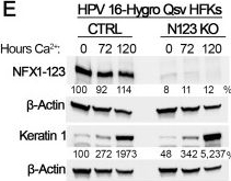 Fig.6.E showing Western Blotting in a Homo sapiens (Human) sample from the publication: NFX1-123 is required for keratinocyte differentiation and HPV 16 DNA maintenance in early and persistent infection models.